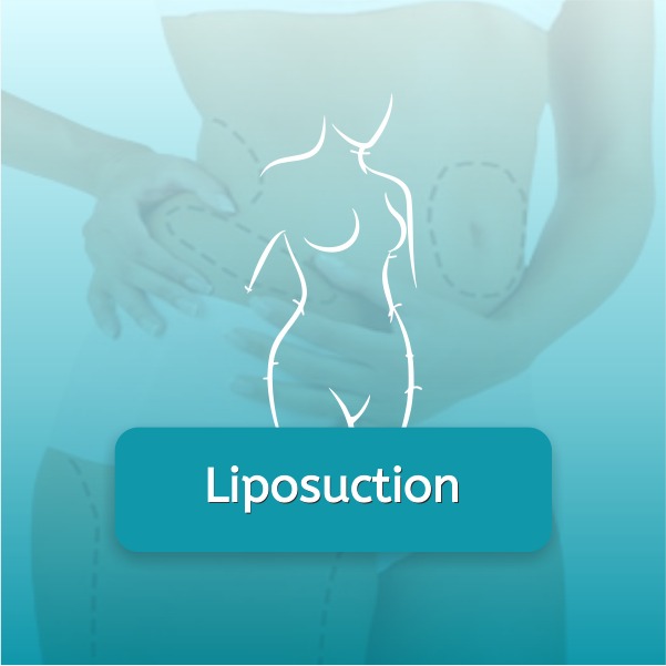 liposuction Surgery in Phi Aesthetics indore