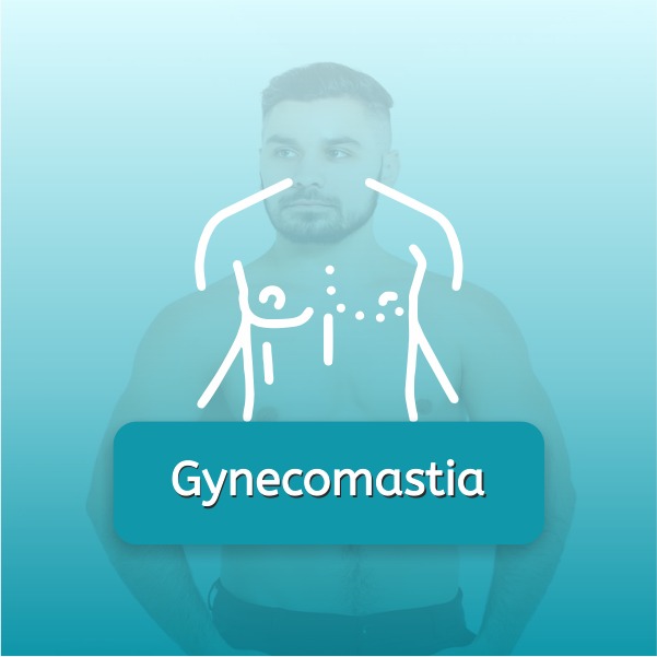 gynecomastia in indore at phi aesthetics