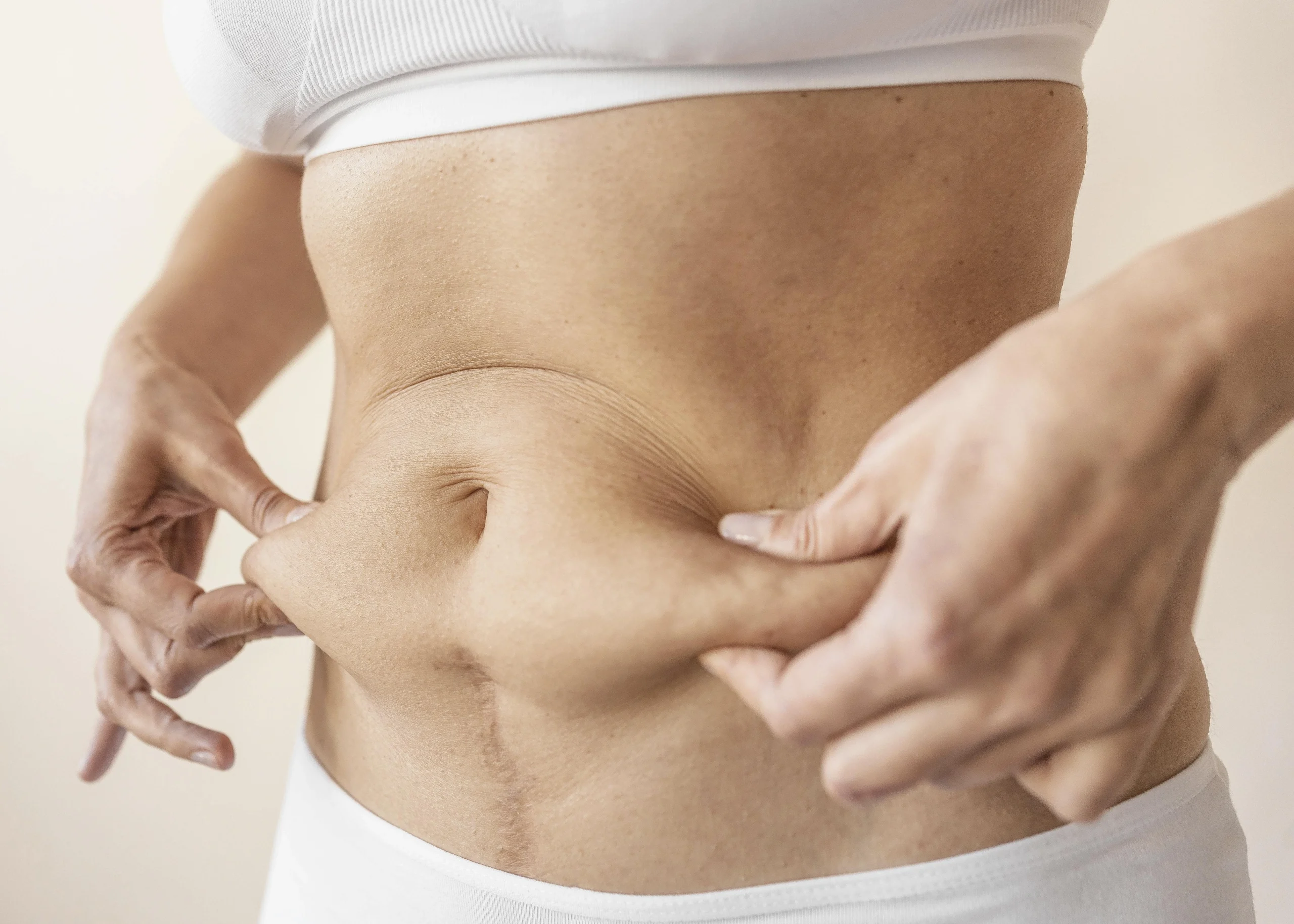Confidence Restored: Living Fully After Abdominoplasty
