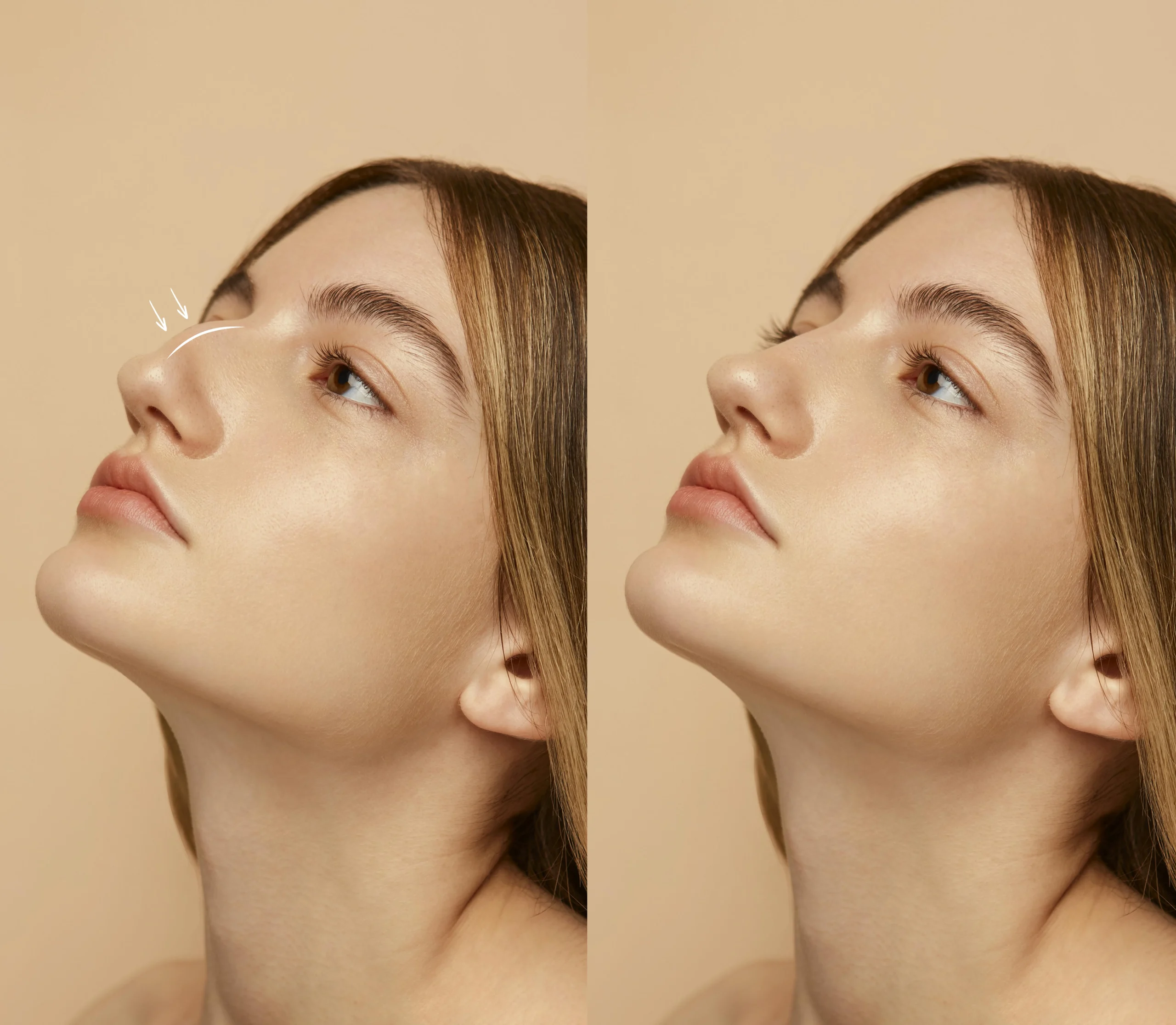 Nose Beauty Standards: How to Know What Suits Your Face Best