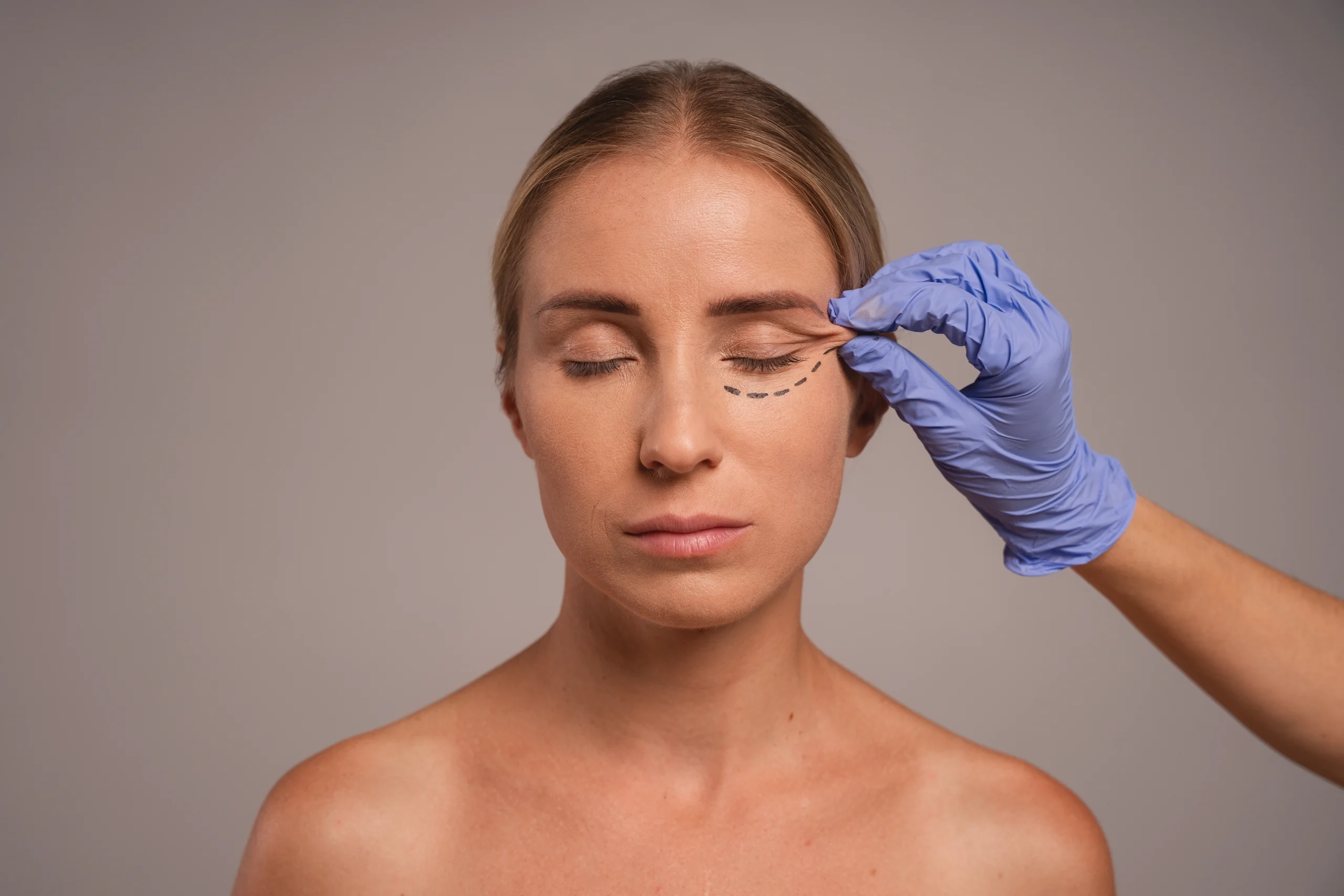 Upper vs Lower Blepharoplasty: What’s the Difference and Which One Do You Need?